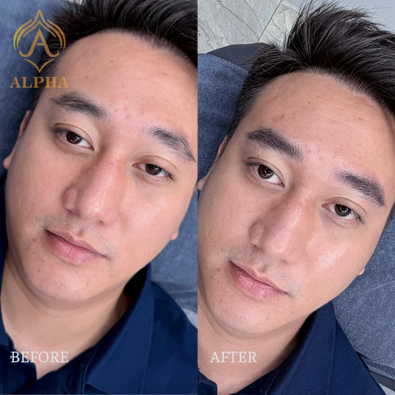 Chân mày nam trước và sau khi điêu khắc tại Alpha Brows